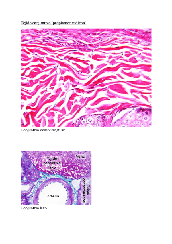 Miniatura del documento Histologia-tejido-conjuntivo-propiamente-dicho.pdf