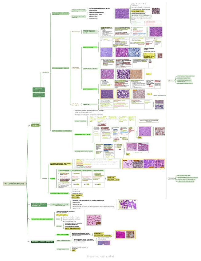 Miniatura del documento Patologia-linfoide-completa--imagenes.pdf