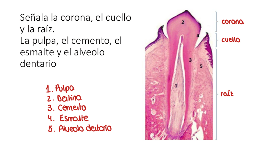Miniatura del documento diente-Ejercicio.pdf