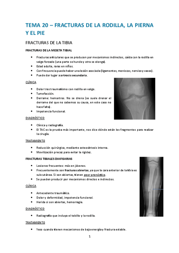 Miniatura del documento Tema-20.-Fracturas-de-la-rodilla-la-pierna-y-el-pie.pdf