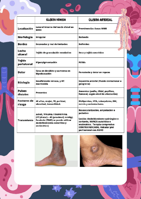 Miniatura del documento ULCERA-VENOSAARTERIAL.pdf