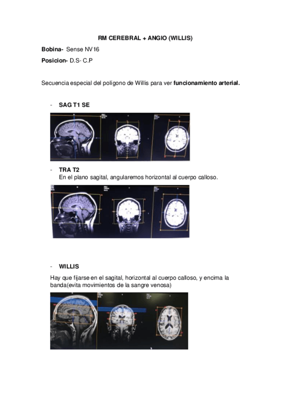 Miniatura del documento RM-CEREBRAL--WILLIS.pdf