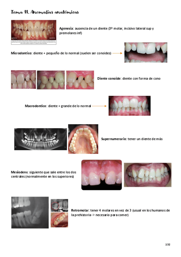Miniatura del documento tema-11-anomalias.pdf