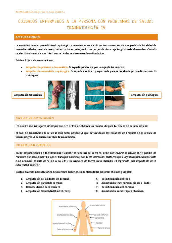 Miniatura del documento Cuidados-enfermeros-a-la-persona-con-problemas-de-salud.-Traumatologia-IV.pdf