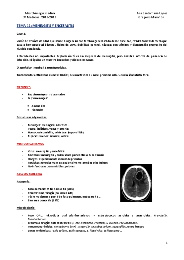 Miniatura del documento Tema 11 - Meningitis y encefalitis.pdf