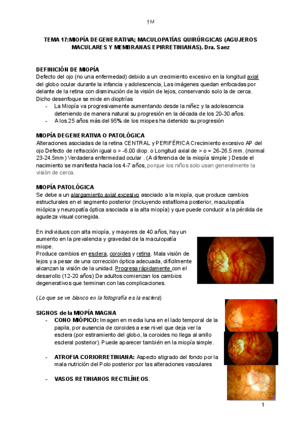 Miniatura del documento TEMA-17MIOPIA-DEGENERATIVA-MACULOPATIAS-QUIRURGICAS-AGUJEROS-MACULARES-Y-MEMBRANAS-EPIRRETINIANAS.pdf