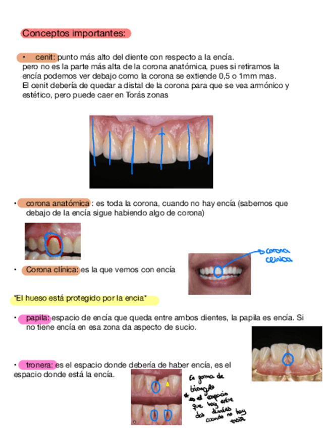 Miniatura del documento Anatomia-II-INCISIVO-CENTRAL-Y-LATERAL-SUPERIOR.pdf
