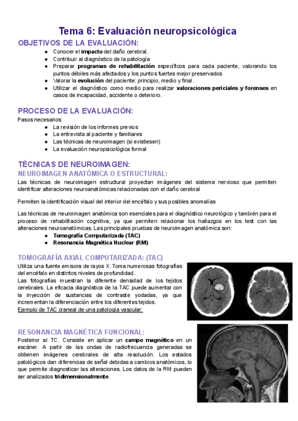 Miniatura del documento Apuntes-neuropsicologia-TEMA-6.pdf