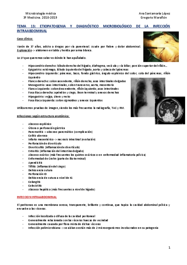 Miniatura del documento Tema 13 - Infección intraabdominal.pdf