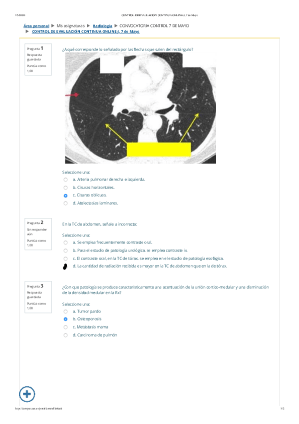 Miniatura del documento examen-radio-parcial-fotos.pdf