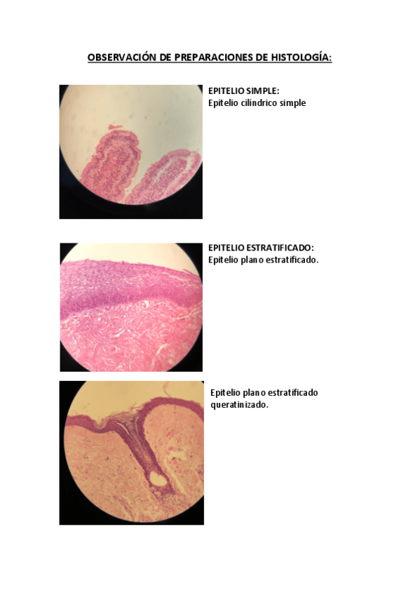Miniatura del documento OBSERVACIÓN DE PREPARACIONES DE HISTOLOGÍA.pdf