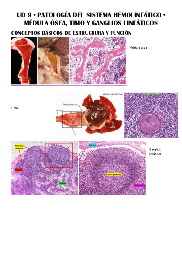 Miniatura del documento UD-9--Patologia-del-Sistema-Hemolinfatico.pdf