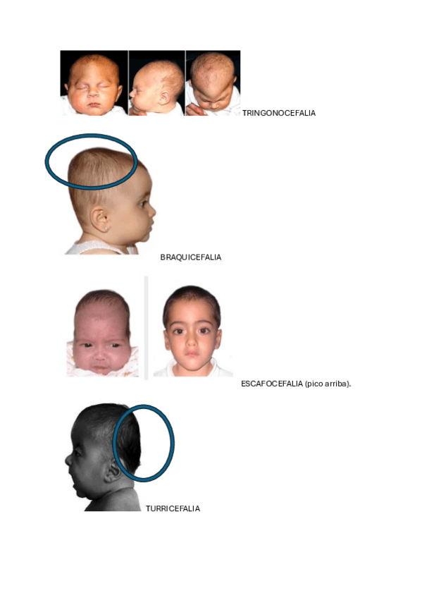 Miniatura del documento ALTERACIONES-CRANEALES.pdf