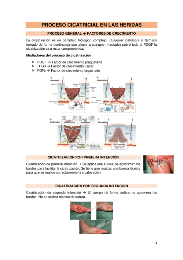 Miniatura del documento 12.-Cicatrizacion.pdf