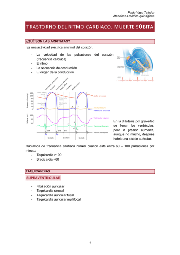 Miniatura del documento TRASTORNO-DEL-RITMO-CARDIACO.-MUERTE-SUBITA.pdf