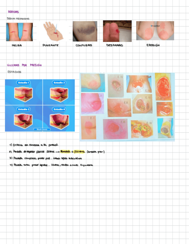 Miniatura del documento Fotos-fisiopatologia-pell.pdf