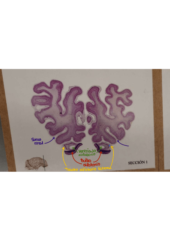 Miniatura del documento Laminas-encefalo-practica-6A.pdf