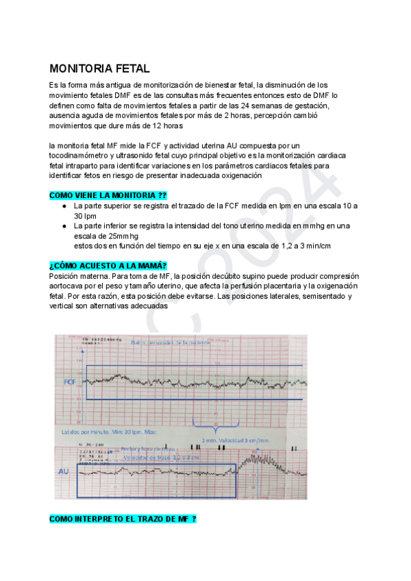 Miniatura del documento PRUEBAS-DE-BIENESTAR-FETAL.-MONITORIA-FETAL.pdf