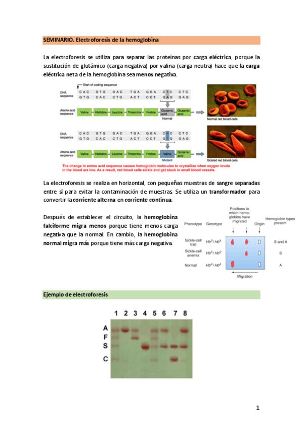 Miniatura del documento SEMINARIO.-ElectroforesisHb.pdf