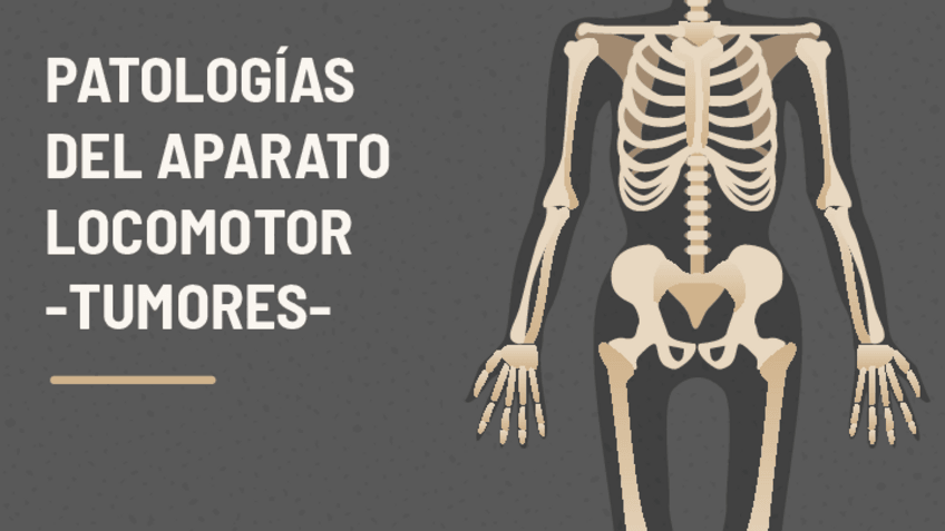 Miniatura del documento TUMORES-OSEOS.pdf