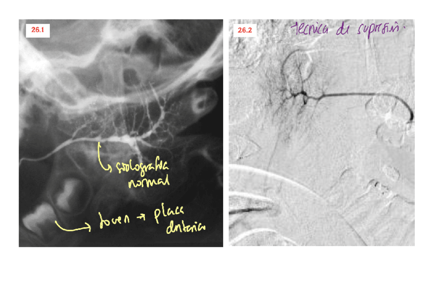 Miniatura del documento ANEXO-T26.pdf