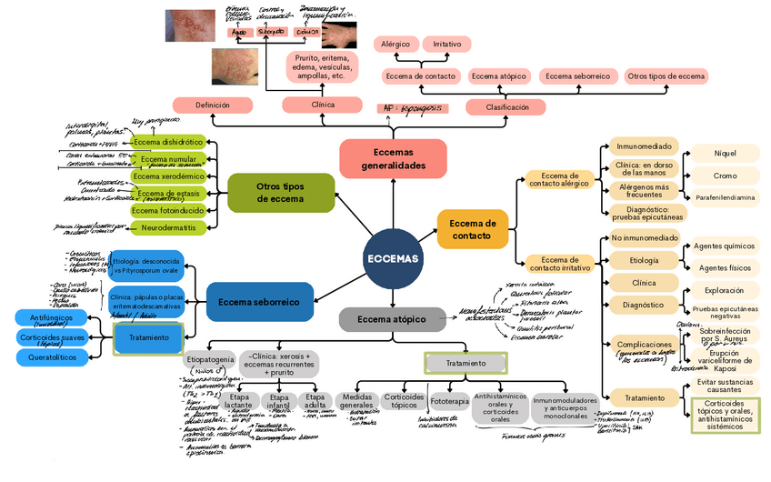 Miniatura del documento ESQUEMA-Eccemas.pdf