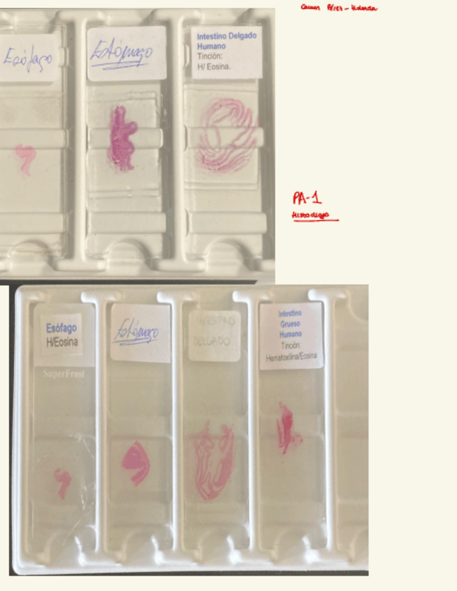 Miniatura del documento Muestras-Explicadas-Histodiges.pdf