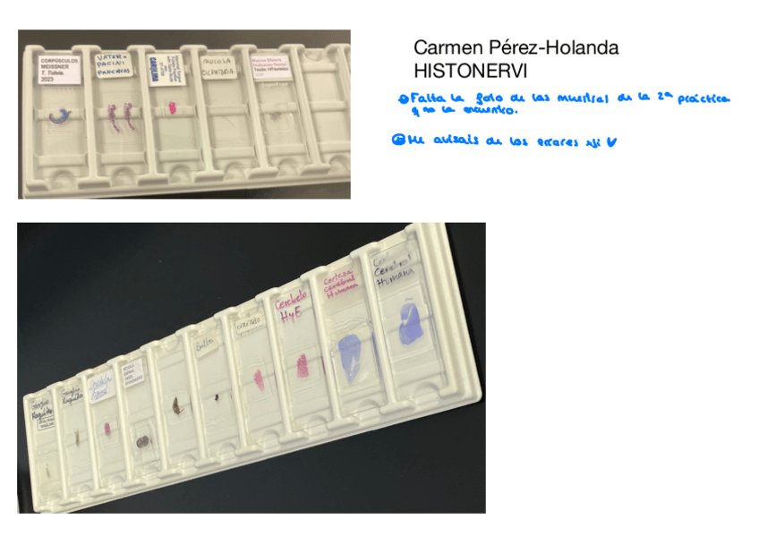 Miniatura del documento Practicas-De-Histonervioso.pdf