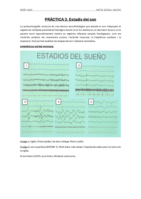 Miniatura del documento PRACTICA-3-RESPI.-ESTADIS-DEL-SON.pdf