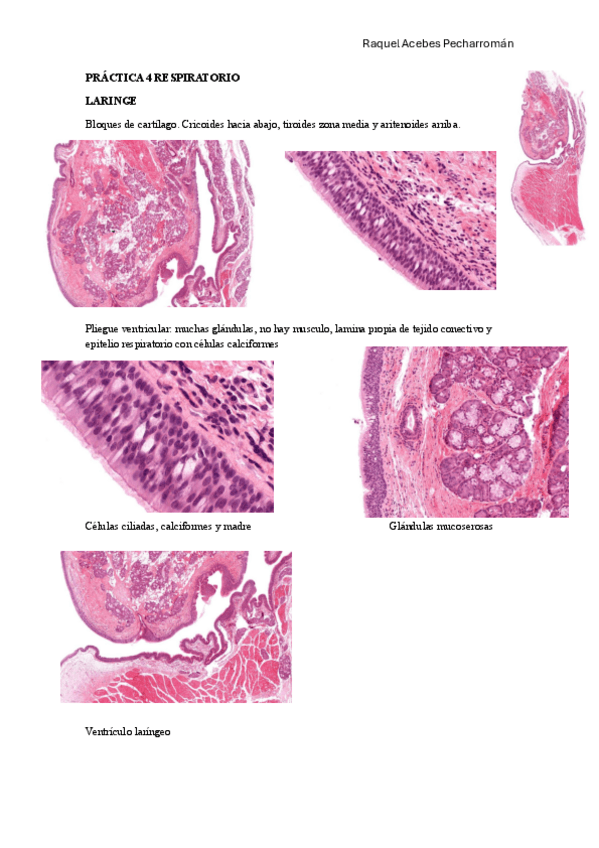 Miniatura del documento practica-respiratorio.pdf