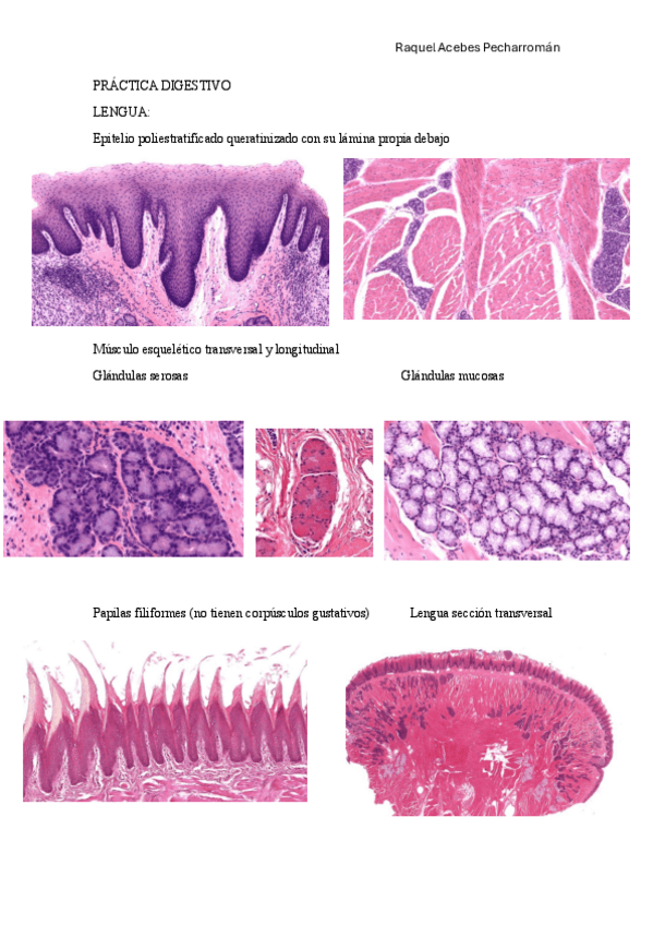 Miniatura del documento practica-1-digestivo.pdf