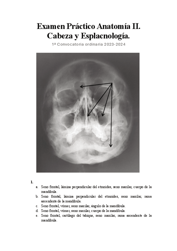 Miniatura del documento Examen-practico-Anatomia-II-2023-2024.pdf