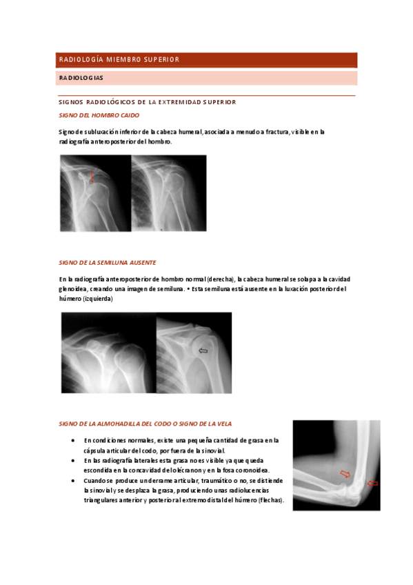 Miniatura del documento Radiologia-miembro-superior-cosas-importantes.pdf