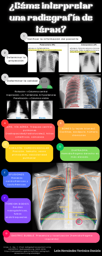 Miniatura del documento Interpretacion-de-radiografia-de-torax.pdf