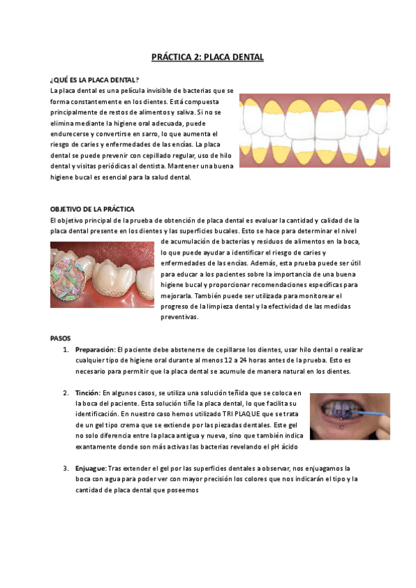 Miniatura del documento PRACTICA-2-Placa-Dental-1.pdf