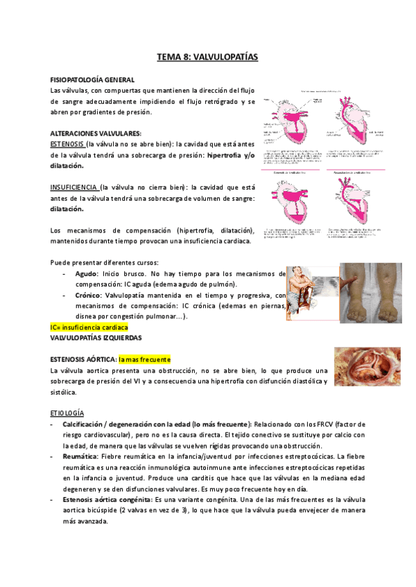 Miniatura del documento TEMA-8-Valvulopatias.pdf