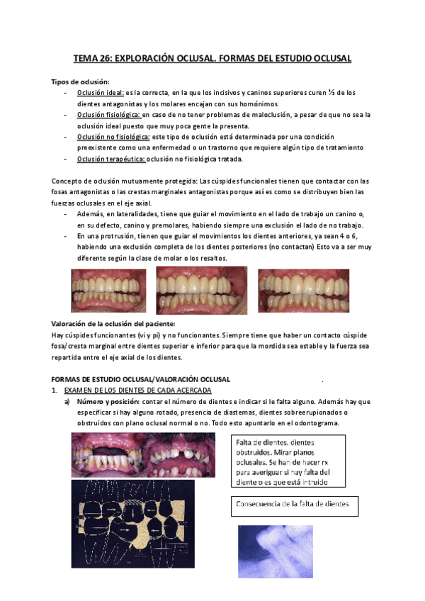 Miniatura del documento TEMA-26-Exploracion-oclusal-formas-del-estudio-oclusal.pdf
