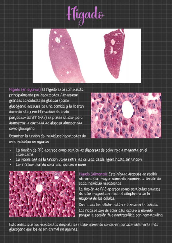 Miniatura del documento Higado.pdf