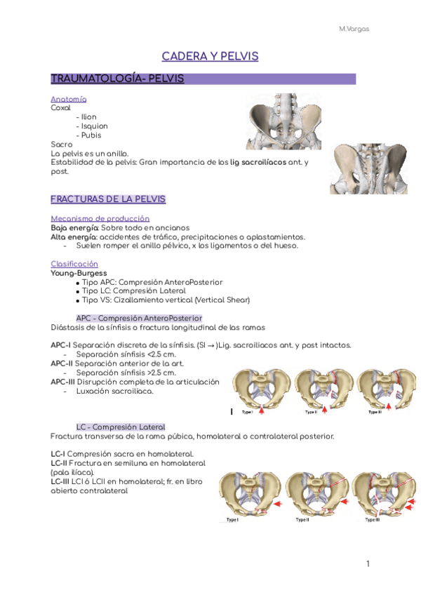 Miniatura del documento TRAUMA-CADERA-Y-PELVIS.pdf