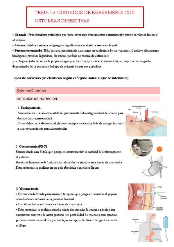 Miniatura del documento tema-10-OSTOMIAS.pdf