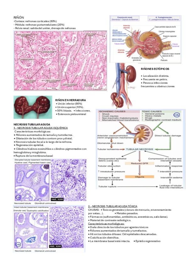 Miniatura del documento RINON.pdf