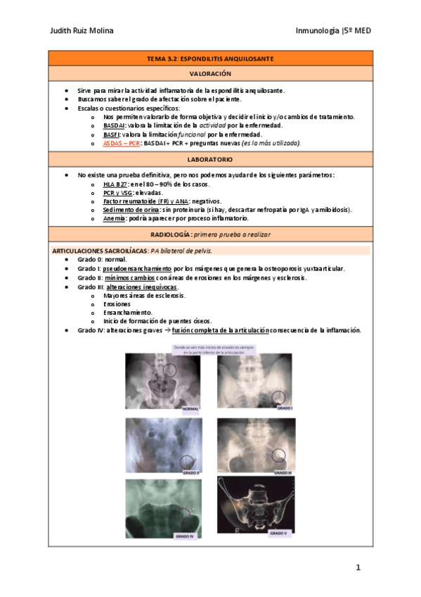 Miniatura del documento TEMA-3.2-ESPONDILITIS-ANQUILOSANTE.pdf
