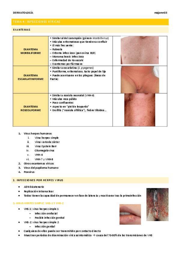 Miniatura del documento Tema-4-Infecciones-viricas.pdf