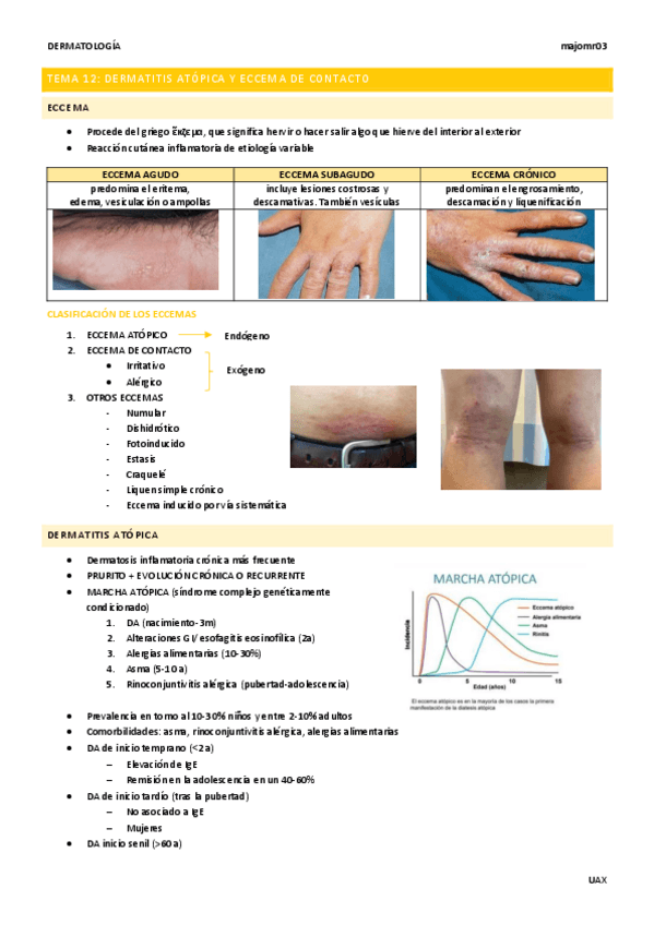 Miniatura del documento Tema-12-Dermatitis-atopica-y-Eccema-de-contacto.pdf