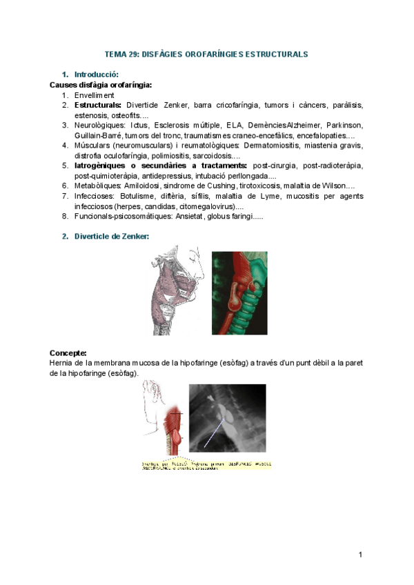Miniatura del documento TEMA-29-DISFAGIES-ESTRUCTURALS.pdf