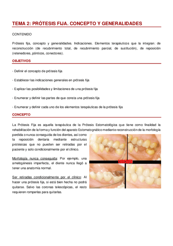 Miniatura del documento TEMA 2 PROTESIS II.pdf