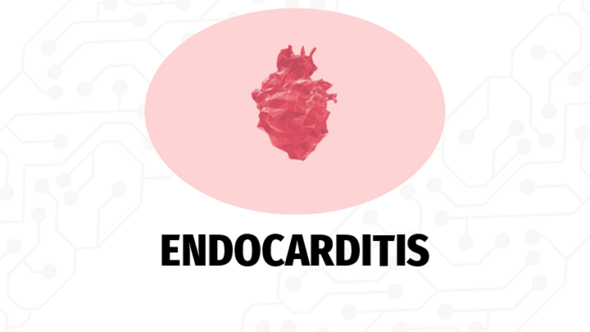 Miniatura del documento Endocarditis-y-miocarditis-IVL.pdf