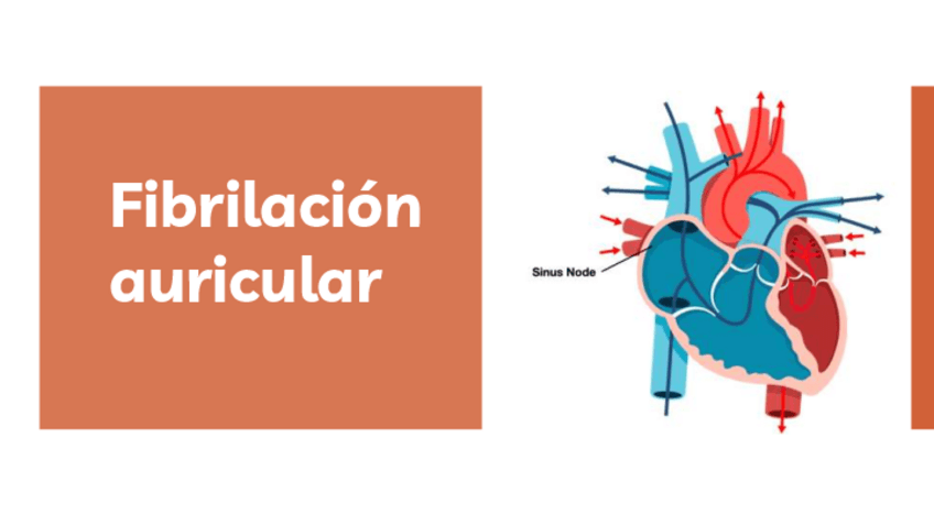 Miniatura del documento Fibrilacion-auricular.pdf