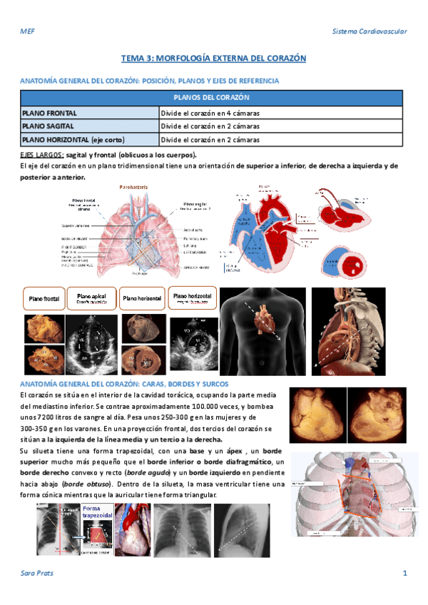 Miniatura del documento TEMA-3-MORFOLOGIA-EXTERNA-DEL-CORAZON.pdf