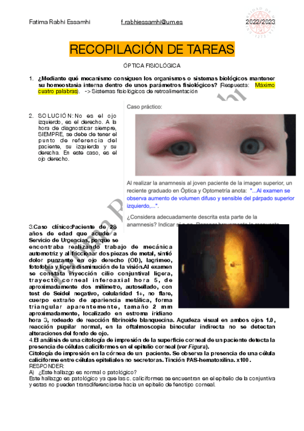 Miniatura del documento TAREAS-fisiologia-ocular.pdf